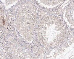 Invitrogen SAV1 Recombinant Rabbit Monoclonal Antibody (PSH04-45) 100 &mu;L;