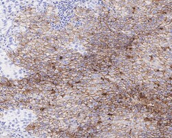 Invitrogen CD30 Recombinant Rabbit Monoclonal Antibody (PSH04-10) 100 &mu;L;