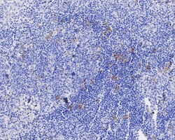 Invitrogen CD30 Recombinant Rabbit Monoclonal Antibody (PSH04-10) 100 &mu;L;