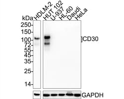Invitrogen CD30 Recombinant Rabbit Monoclonal Antibody (PSH04-10) 100 &mu;L;