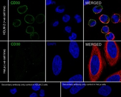Invitrogen CD30 Recombinant Rabbit Monoclonal Antibody (PSH04-11) 100 &mu;L;