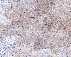 Invitrogen CD30 Recombinant Rabbit Monoclonal Antibody (PSH04-11) 100 &mu;L;