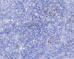 Invitrogen CD30 Recombinant Rabbit Monoclonal Antibody (PSH04-11) 100 &mu;L;