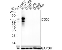 Invitrogen CD30 Recombinant Rabbit Monoclonal Antibody (PSH04-11) 100 &mu;L;