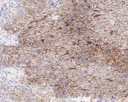 Invitrogen CD30 Recombinant Rabbit Monoclonal Antibody (PSH04-12) 100 &mu;L;