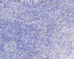 Invitrogen CD30 Recombinant Rabbit Monoclonal Antibody (PSH04-12) 100 &mu;L;