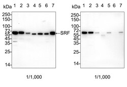 Invitrogen SRF Recombinant Rabbit Monoclonal Antibody (PSH05-06) 100 &mu;L;