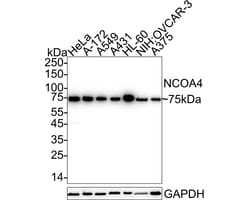 Invitrogen NCOA4 Recombinant Rabbit Monoclonal Antibody (PSH05-44) 100