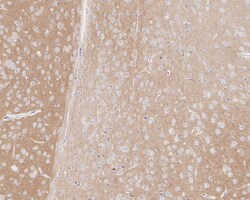 Invitrogen TrkC Recombinant Rabbit Monoclonal Antibody (PSH05-40) 100 &mu;L;