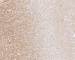 Invitrogen TrkC Recombinant Rabbit Monoclonal Antibody (PSH05-40) 100 &mu;L;