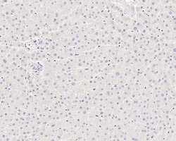 Invitrogen TrkC Recombinant Rabbit Monoclonal Antibody (PSH05-40) 100 &mu;L;