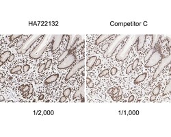 Invitrogen H3K9ac Recombinant Rabbit Monoclonal Antibody (PSH04-47) 100