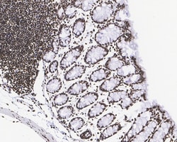 Invitrogen H3K27me3 Recombinant Rabbit Monoclonal Antibody (PSH05-15) 100