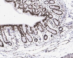 Invitrogen H3K27me3 Recombinant Rabbit Monoclonal Antibody (PSH05-15) 100