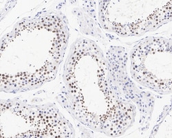 Invitrogen POLL Recombinant Rabbit Monoclonal Antibody (PSH05-24) 100 &mu;L;