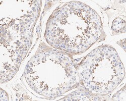 Invitrogen LNP Recombinant Mouse Monoclonal Antibody (11-1-R) 100 &mu;L;