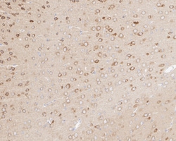 Invitrogen LNP Recombinant Mouse Monoclonal Antibody (11-1-R) 100 &mu;L;