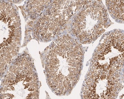 Invitrogen LNP Recombinant Mouse Monoclonal Antibody (11-1-R) 100 &mu;L;