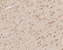 Invitrogen LNP Recombinant Mouse Monoclonal Antibody (11-1-R) 100 &mu;L;