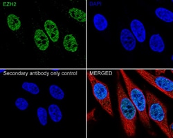 Invitrogen EZH2 Recombinant Rabbit Monoclonal Antibody (PSH04-14) 100 &mu;L;