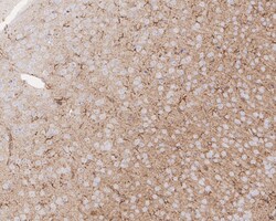 Invitrogen CPT1A Recombinant Rabbit Monoclonal Antibody (PSH04-00) 100