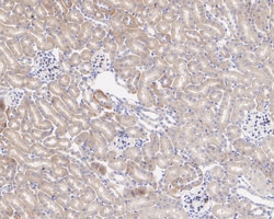Invitrogen CPT1A Recombinant Rabbit Monoclonal Antibody (PSH04-00) 100