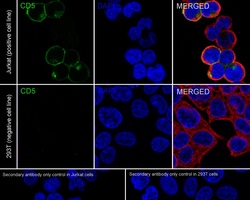 Invitrogen CD5 Recombinant Rabbit Monoclonal Antibody (PSH05-01) 100 &mu;L;
