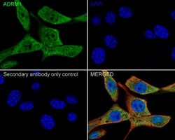 Invitrogen ADRM1 Recombinant Rabbit Monoclonal Antibody (PSH05-41) 100