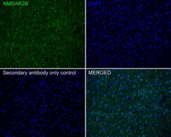 Invitrogen NMDAR2B Recombinant Rabbit Monoclonal Antibody (PSH05-46) 100