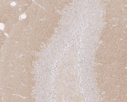 Invitrogen NMDAR2B Recombinant Rabbit Monoclonal Antibody (PSH05-46) 100