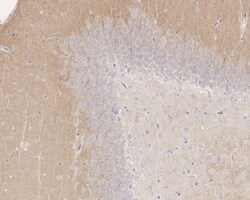 Invitrogen NMDAR2B Recombinant Rabbit Monoclonal Antibody (PSH05-46) 100