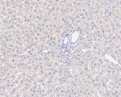 Invitrogen NMDAR2B Recombinant Rabbit Monoclonal Antibody (PSH05-46) 100