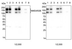 Invitrogen NMDAR2B Recombinant Rabbit Monoclonal Antibody (PSH05-46) 100