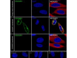 Invitrogen CD200R Recombinant Rabbit Monoclonal Antibody (PSH05-02) 100