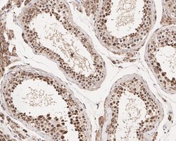 Invitrogen HDJ2 Recombinant Rabbit Monoclonal Antibody (JE40-13) 100 &mu;L;