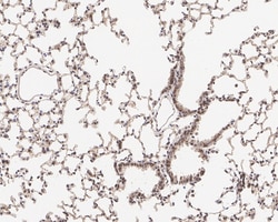 Invitrogen HDJ2 Recombinant Rabbit Monoclonal Antibody (JE40-13) 100 &mu;L;
