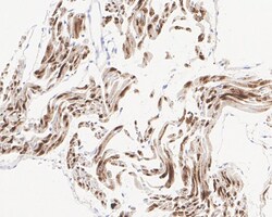 Invitrogen PKM1 Recombinant Rabbit Monoclonal Antibody (PSH04-37) 100 &mu;L;