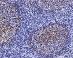 Invitrogen Apolipoprotein J Recombinant Rabbit Monoclonal Antibody (PSH04-33)