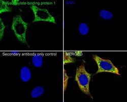 Invitrogen PABP Recombinant Rabbit Monoclonal Antibody (PSH05-51) 100 &mu;L;