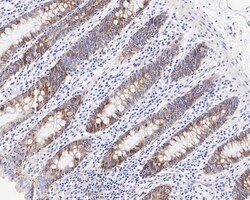 Invitrogen PABP Recombinant Rabbit Monoclonal Antibody (PSH05-51) 100 &mu;L;