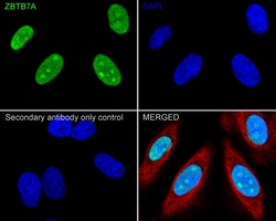 Invitrogen Pokemon Recombinant Rabbit Monoclonal Antibody (JE34-74) 100