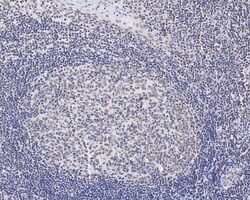 Invitrogen Pokemon Recombinant Rabbit Monoclonal Antibody (JE34-74) 100