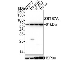 Invitrogen Pokemon Recombinant Rabbit Monoclonal Antibody (JE34-74) 100