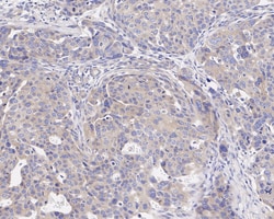 Invitrogen GSK3 alpha Recombinant Rabbit Monoclonal Antibody (JE33-27)