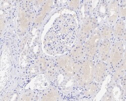 Invitrogen GSK3 alpha Recombinant Rabbit Monoclonal Antibody (JE33-27)