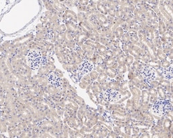 Invitrogen GSK3 alpha Recombinant Rabbit Monoclonal Antibody (JE33-27)