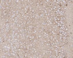 Invitrogen BACE1 Recombinant Rabbit Monoclonal Antibody (PSH05-19) 100