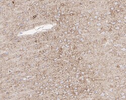 Invitrogen BACE1 Recombinant Rabbit Monoclonal Antibody (PSH05-19) 100