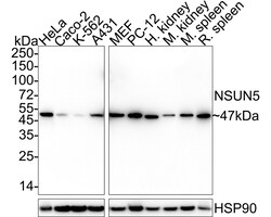 Invitrogen NSUN5 Recombinant Rabbit Monoclonal Antibody (PSH05-07) 100