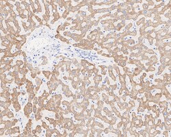 Invitrogen ALDH4A1 Recombinant Mouse Monoclonal Antibody (7E2-R) 100 &mu;L;